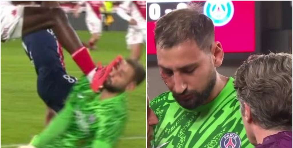 Es un escándalo: le pisó la cara a Donnarumma y el árbitro solo le sacó amarilla