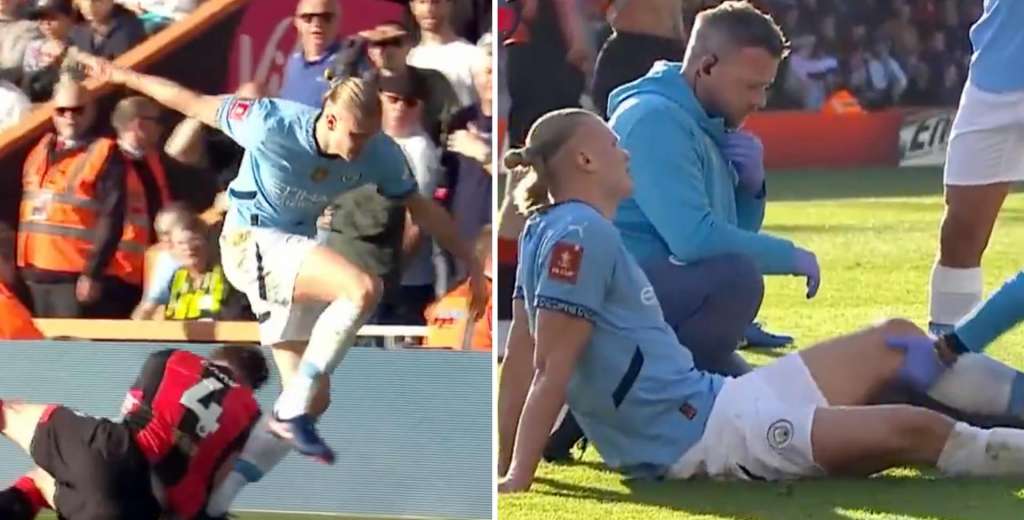 Duele de solo verlo: la jugada en donde se lesionó Haaland