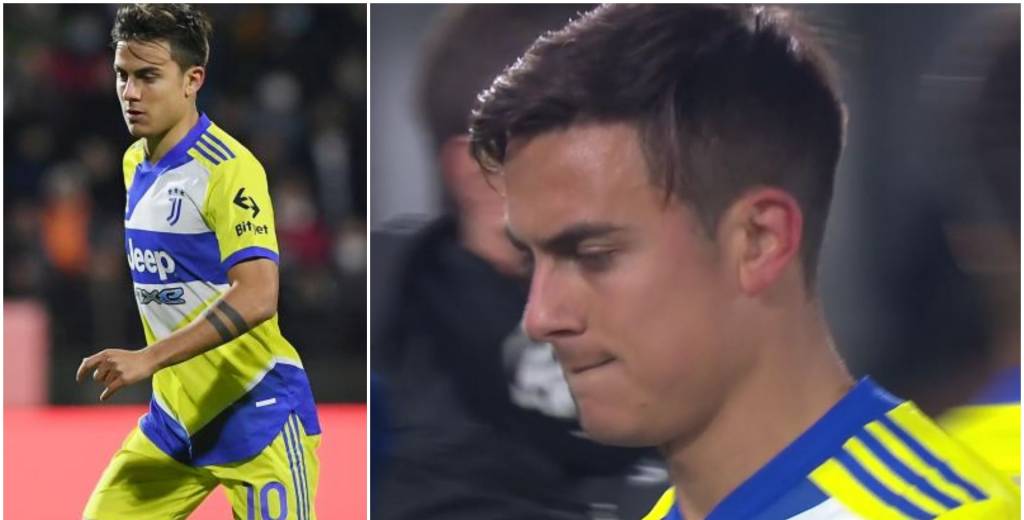 Dybala se va lesionado a los 10 minutos y su cara lo dice todo