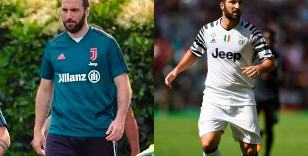 Higuaín y la feroz respuesta a las críticas por su sobrepeso en Juventus