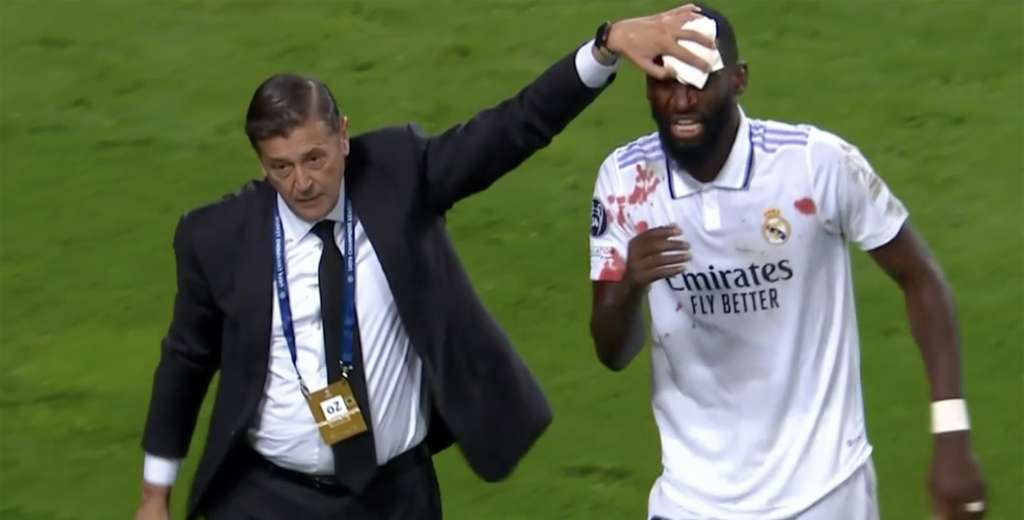 Impresionante: Rudiger empató para el Madrid y terminó ensangrentado