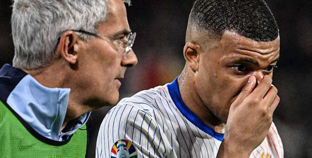 Mbappé toma la decisión final tras su fractura de nariz: Francia sufre...